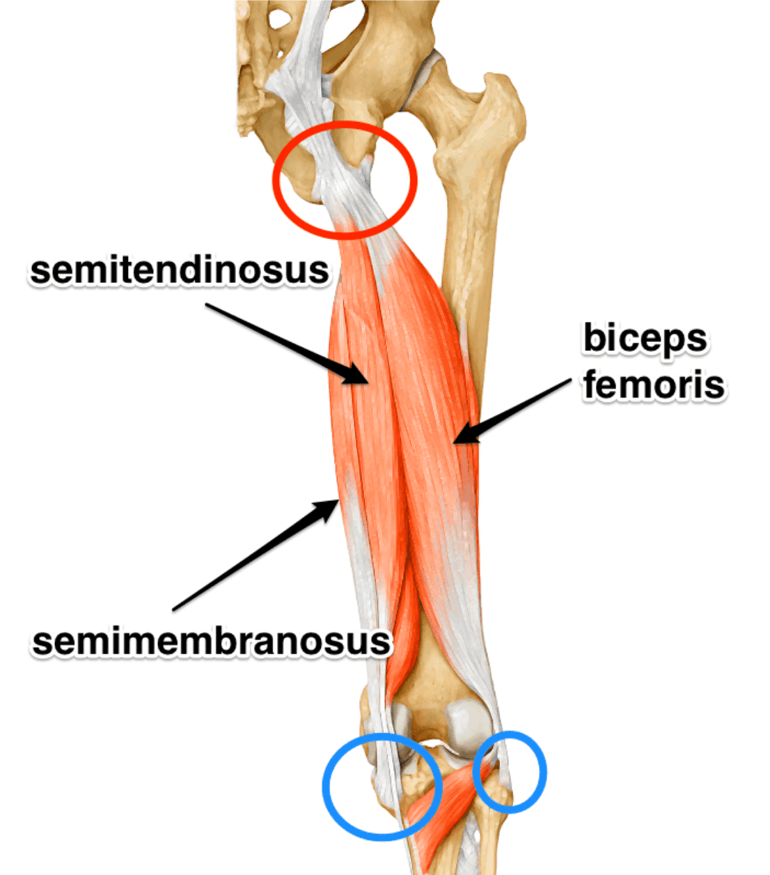 Hamstring Tendinopathy illustration