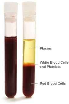PRP + Protein Concentrate illustration