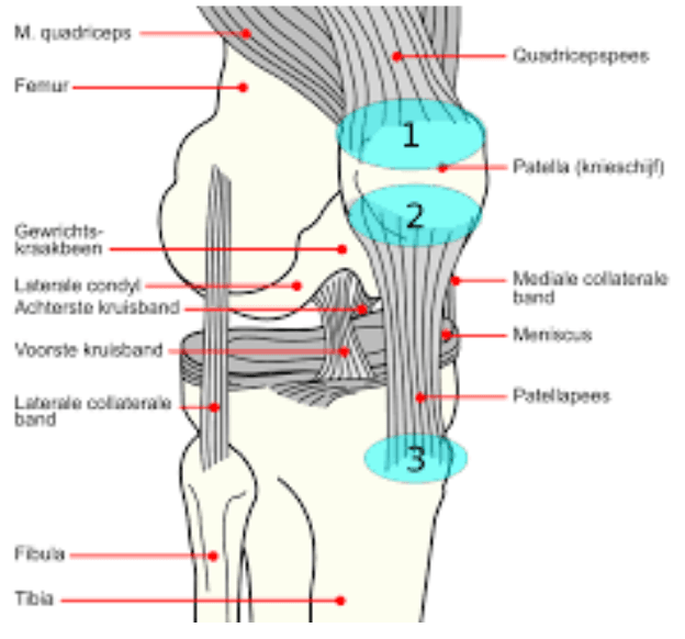 Quadriceps Tendinopathy illustration
