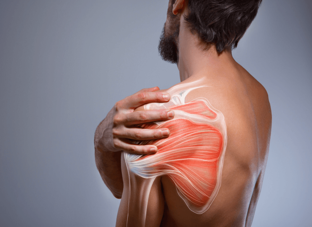 Rotator Cuff Tear illustration